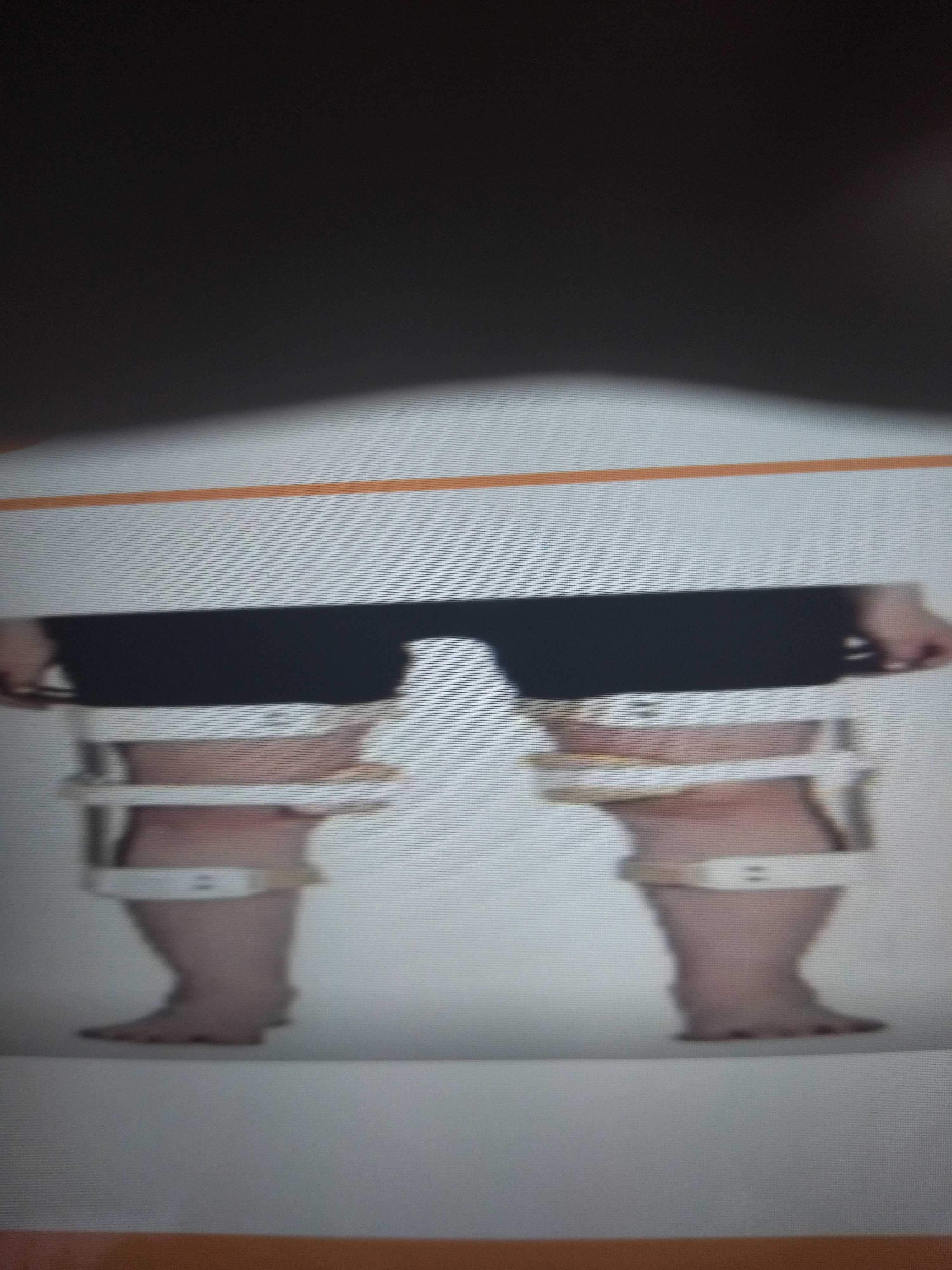 * aka straps
* It buckles one upright to pull the knee (ex. If shell is on medial, then it is anchored on lateral upright)
* Uses MediVal LaVarus