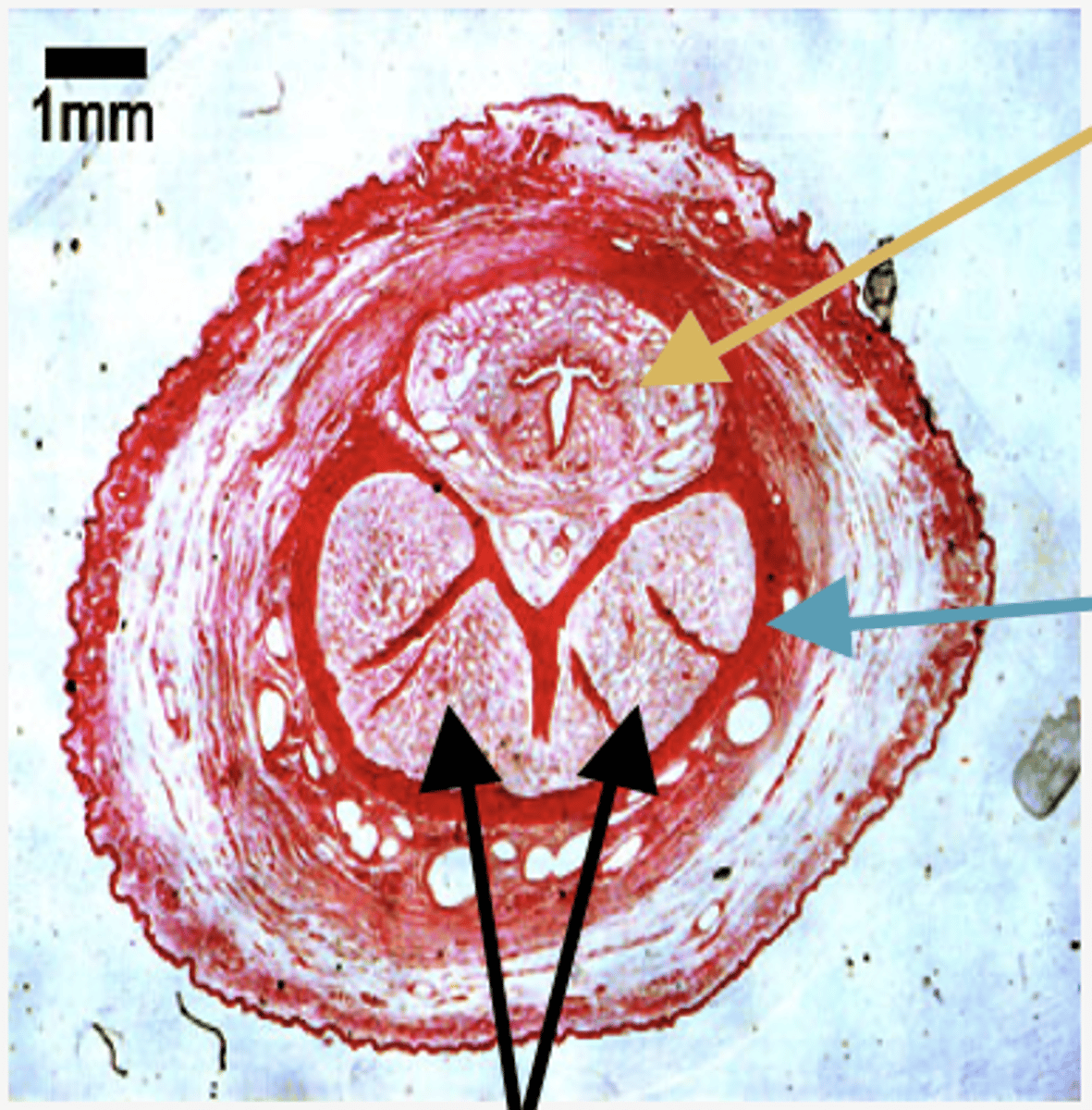 <p>Identify the region (YELLOW ARROW)</p>