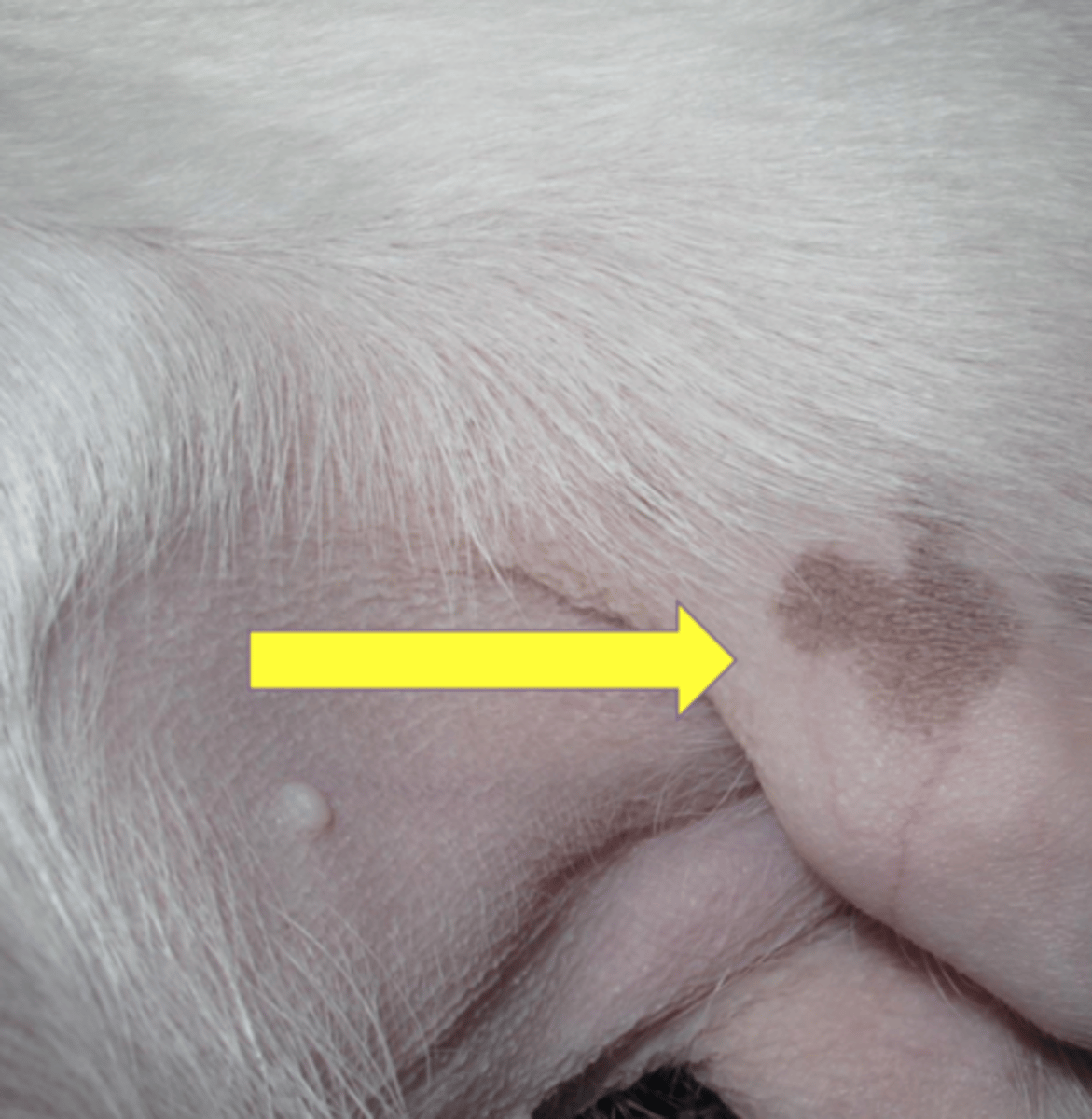 <p>What lesion is this? Is it primary or secondary?</p>