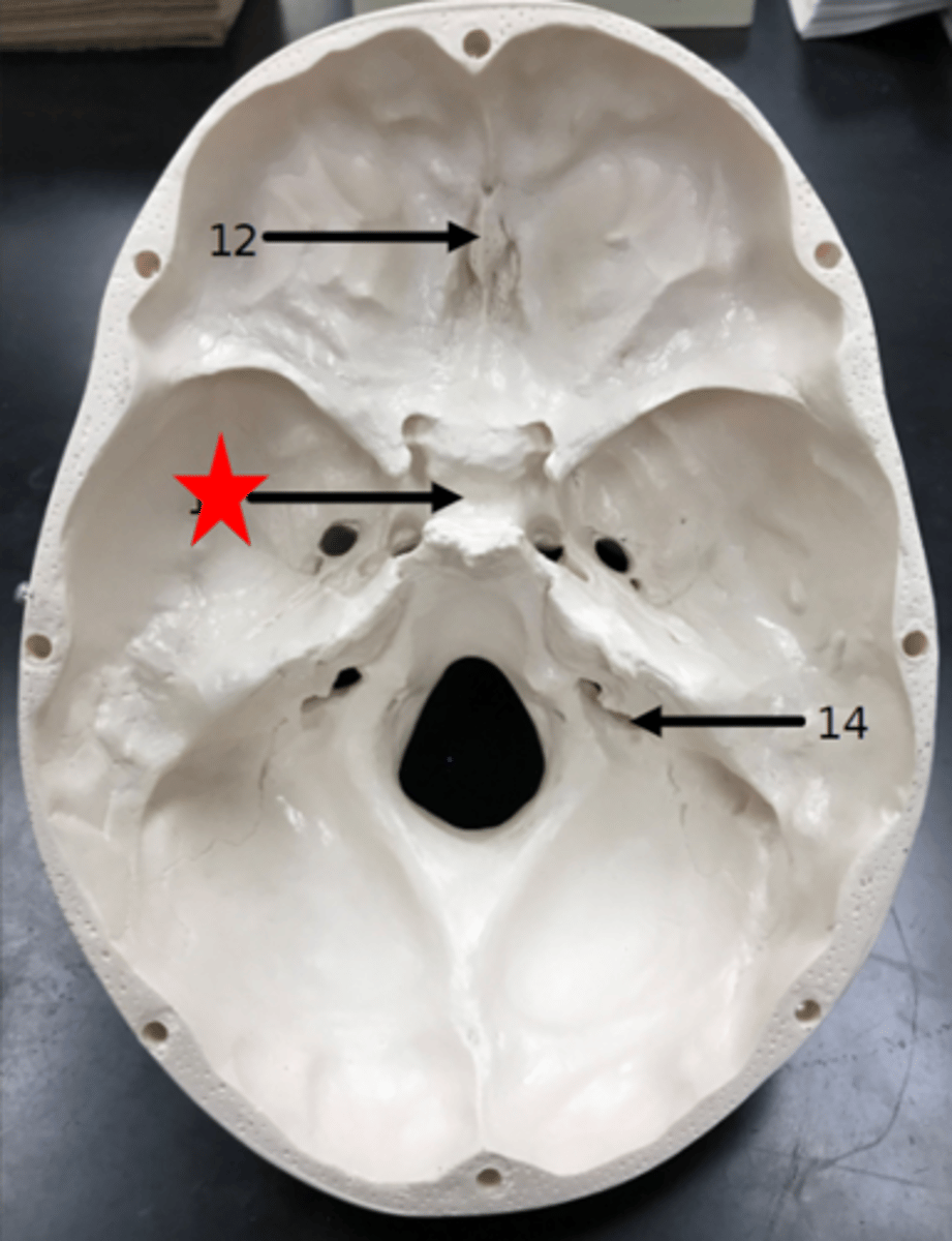 <p>Name the starred region in the image.</p>