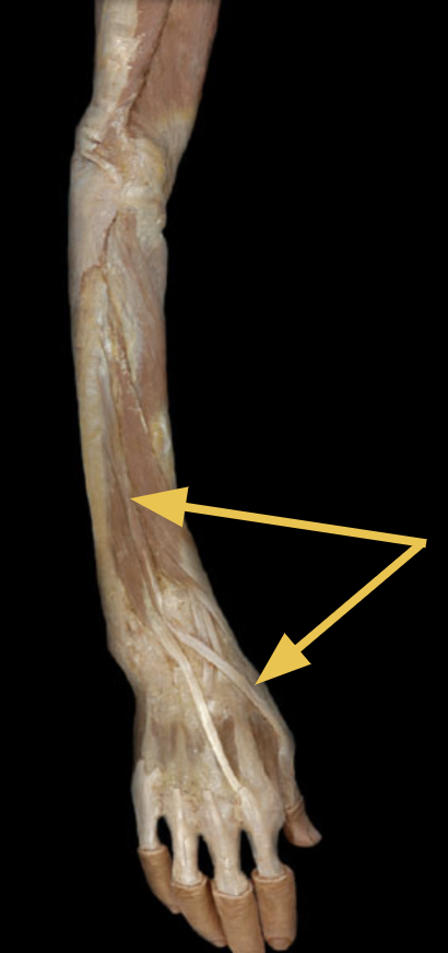 <p>identify + state origin, insertion, action, innervation of marked structure</p>