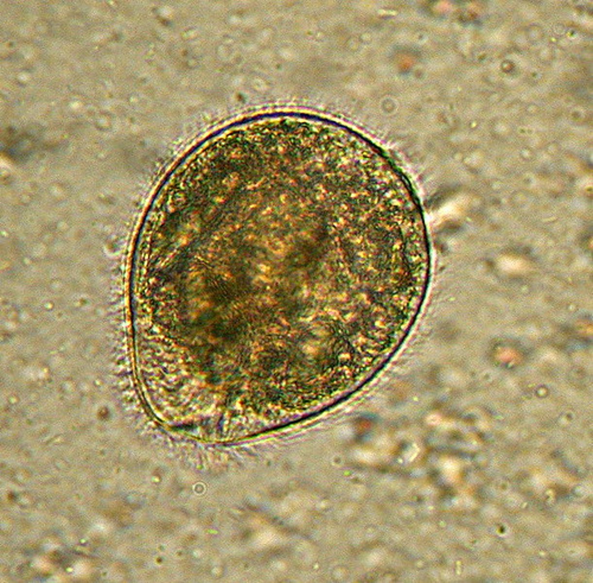 <p>• Cyst</p><p>o Infrequently seen</p><p>• Trophozoite</p><p>o Large, up to 200 microns</p><p>o Cytostome and cilia</p><p>Kidney bean</p>