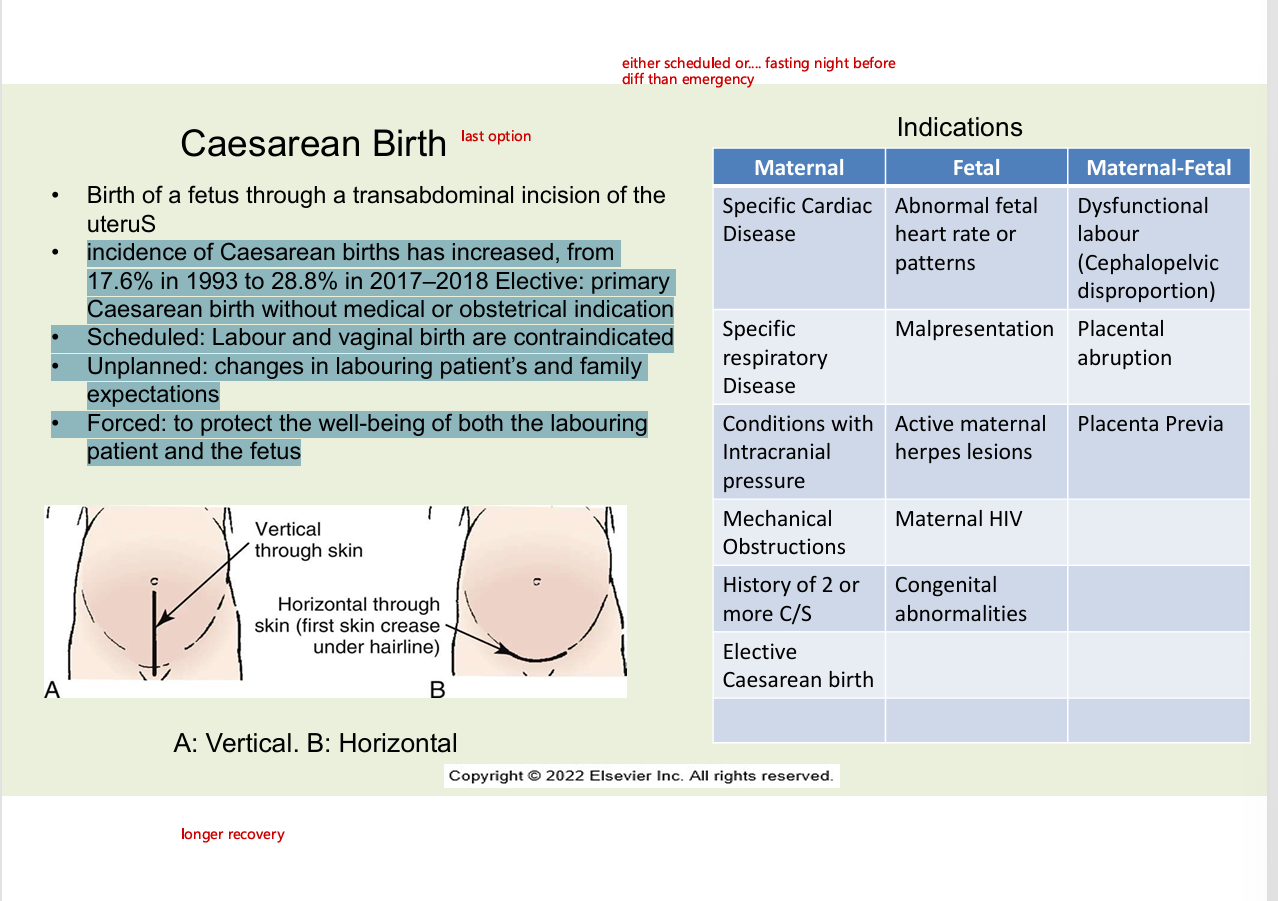 <ul><li><p>birth fo fetus through transabdominal incision of the uterus</p></li><li><p>incidence of Caesarean births has increased, from 17.6% in 1993 to 28.8% in 2017–2018 Elective: primary Caesarean birth without medical or obstetrical indication</p></li><li><p> • Scheduled: Labour and vaginal birth are contraindicated </p></li><li><p>• Unplanned: changes in labouring patient’s and family expectations </p></li><li><p>• Forced: to protect the well-being of both the labouring patient and the fetus</p></li><li><p>review chart image for indications</p></li><li><p></p></li></ul><p></p>