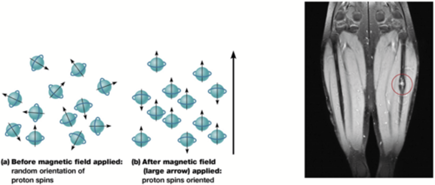 <p>Door een oscillerend magnetisch veld aan en af zetten, die energie wordt elke keer losgelaten </p><p>-> radiogolven die we detecteren</p><p>De snelheid van de energie heeft te maken met het aantal water in de cel</p><p>-> meer/minder water in tumoren dan in gezond weefsel en zo kunnen we deze zien</p><p>Een MR of MRI (Magnetische resonantie / Magnetic Resonance Imaging) is een onderzoekstechniek die gebruik maakt van sterke magneetvelden en radiogolven (geen röntgenstraling) om organen en andere lichaamsweefsels gedetailleerd in kaart te brengen.</p>