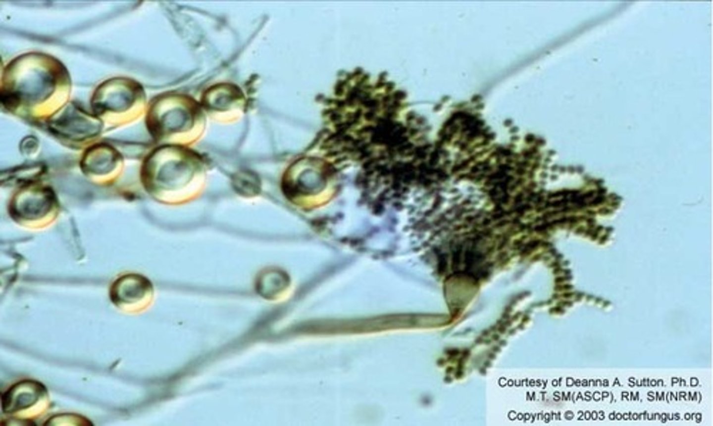 <p>Contains hulle cells</p>