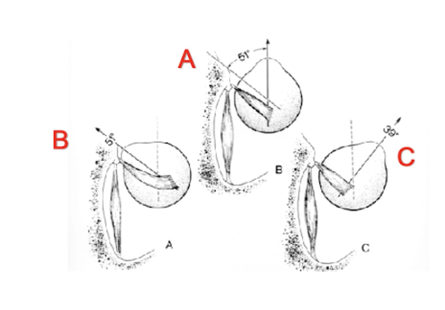 <p>adduct 51º (B)</p>