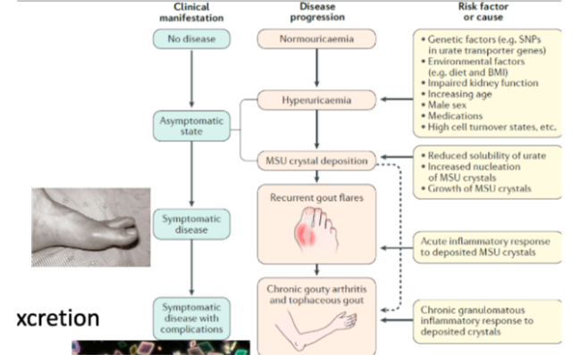 <p>Gouty Arthritis</p>