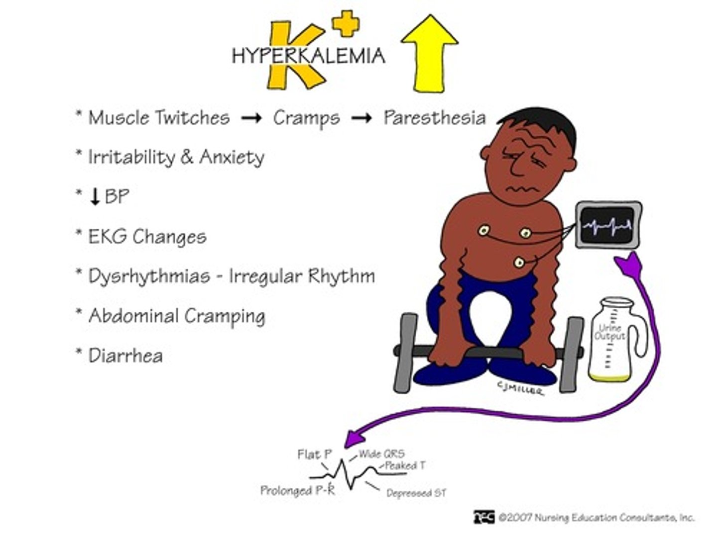 <p>Heart</p><p>- Arrhythmias: Cardiac standstill</p><p>- Hypotension</p><p>- Bradycardia</p><p>- Tall T waves on EKG</p><p>Neuromuscular</p><p>- Paresthesia (pins and needles)</p><p>- Weakness/dizziness</p><p>- Muscle cramps</p><p>GI</p><p>- Abdominal cramping</p><p>- Increased motility (hyperactive bowel sounds)</p><p>- Diarrhea, nausea, vomiting</p>