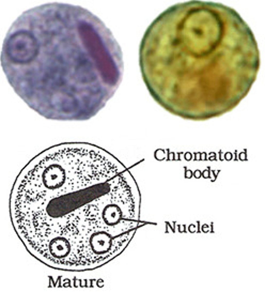 <p>This trophozoite represents the major amoebic pathogen for humans. The characteristic BULL's EYE nucleus, consisting a central karyosome and even, fine peripheral chromatin, helps identify this protozoan as:</p>
