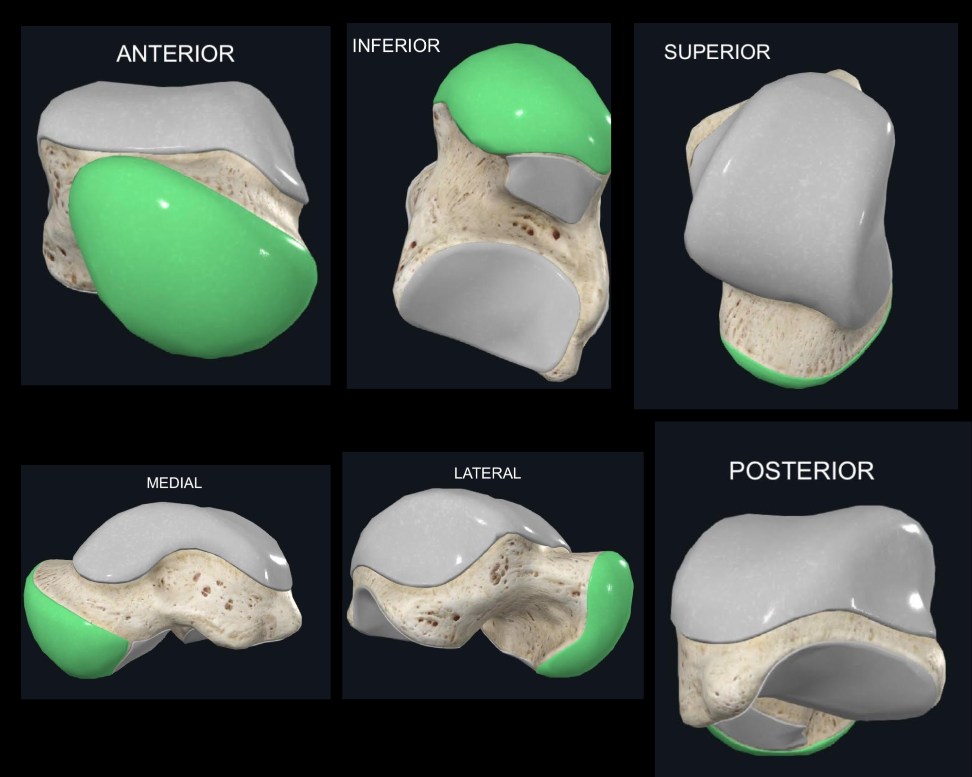 <p>Anterior, superior, inferior, posterior, medial y lateral</p>