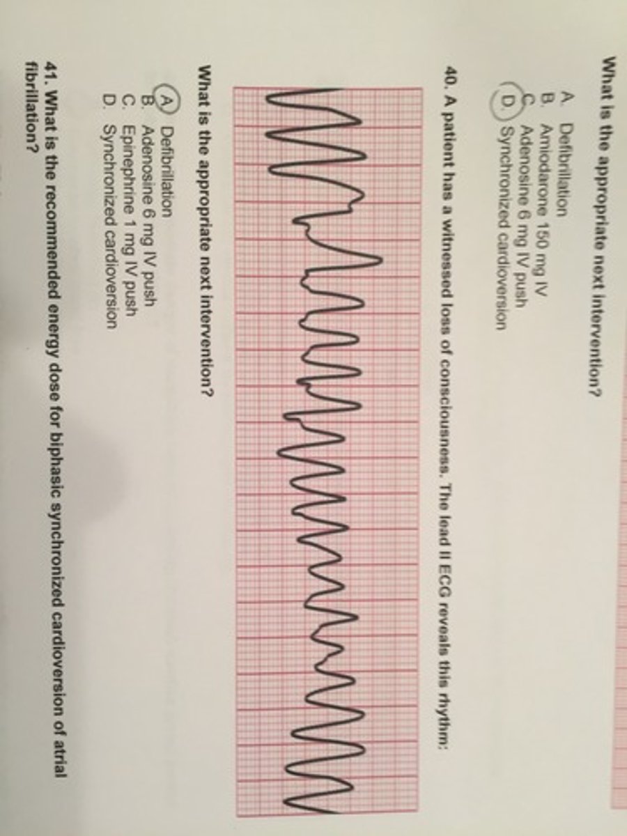 <p>Defibrillation</p>