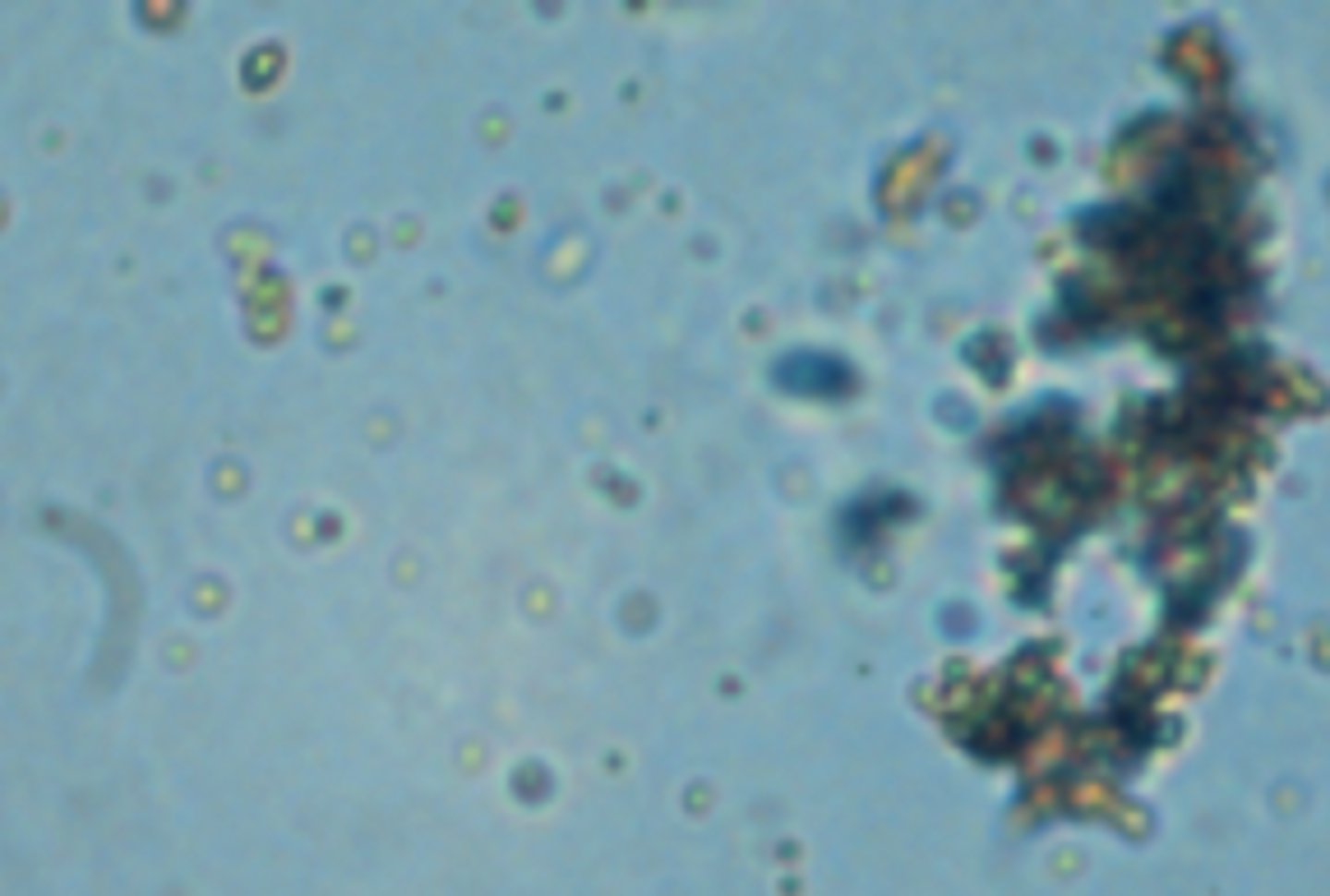 <p>Dark or yellow-red granules, Urine pH: Acidic</p>