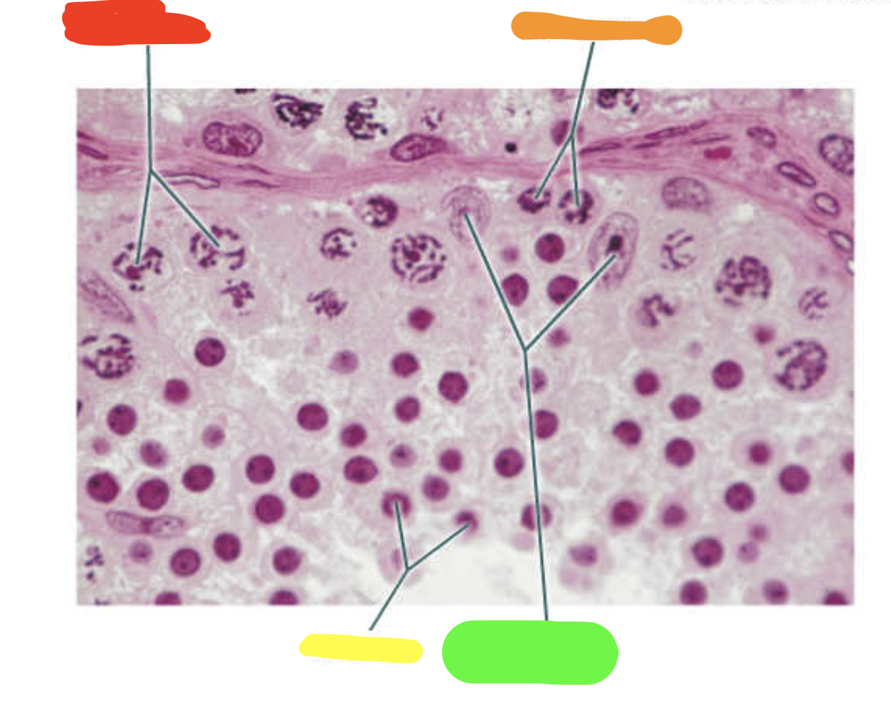 <p>What is this a slide of?</p>