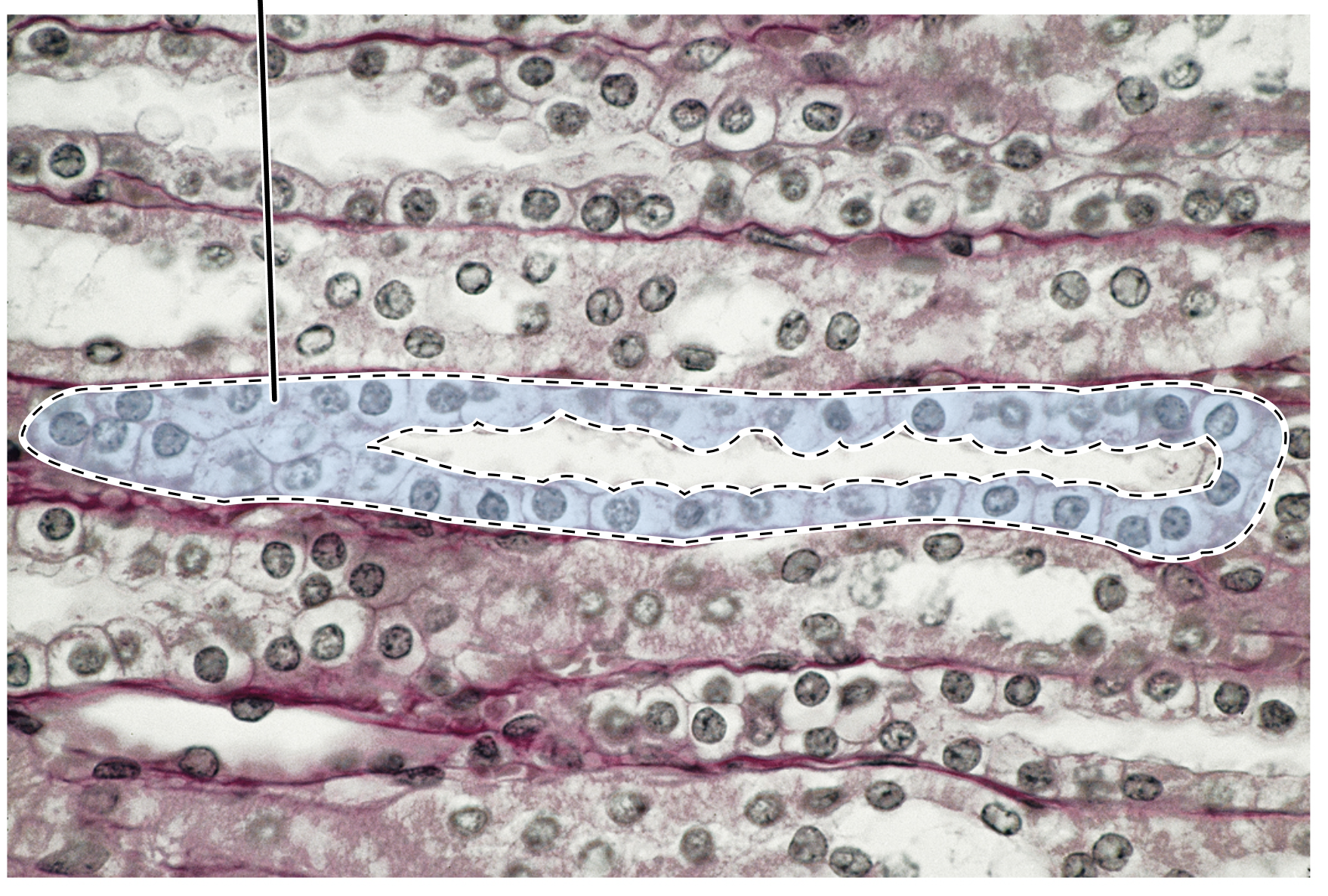 <p>Name the highlighted tissue.</p>