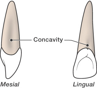 <p>Depressions or indentations in the root surface. They can harvest bacteria and cause periodontal disease</p>