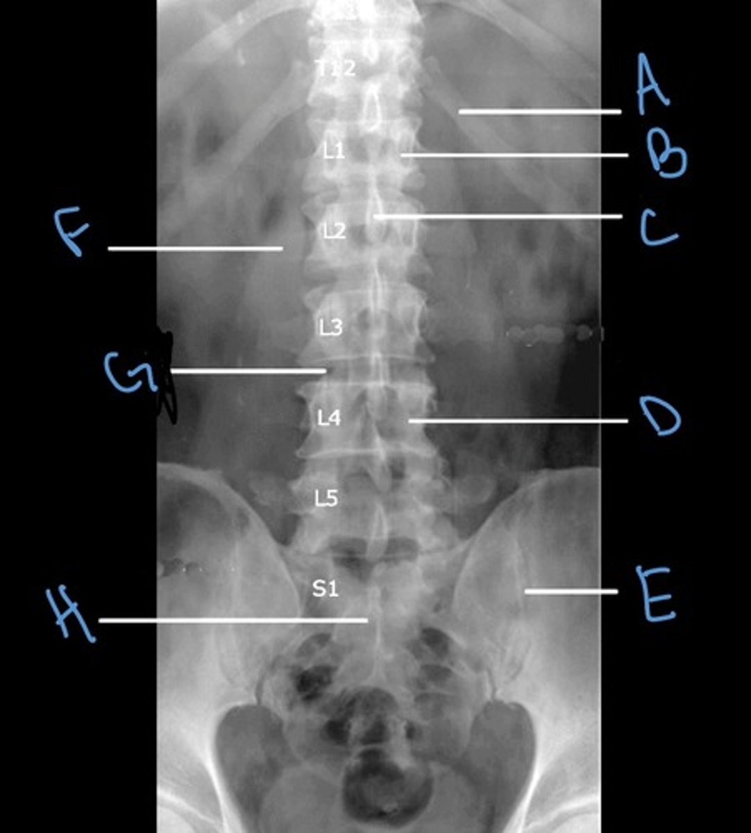 <p>Label the anatomy indicated by letter E:</p>