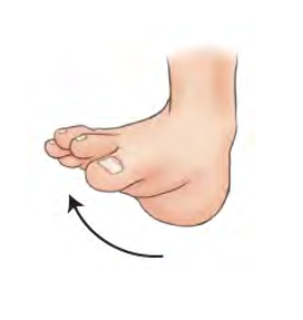 <p>Stress movement of ankle joint </p>