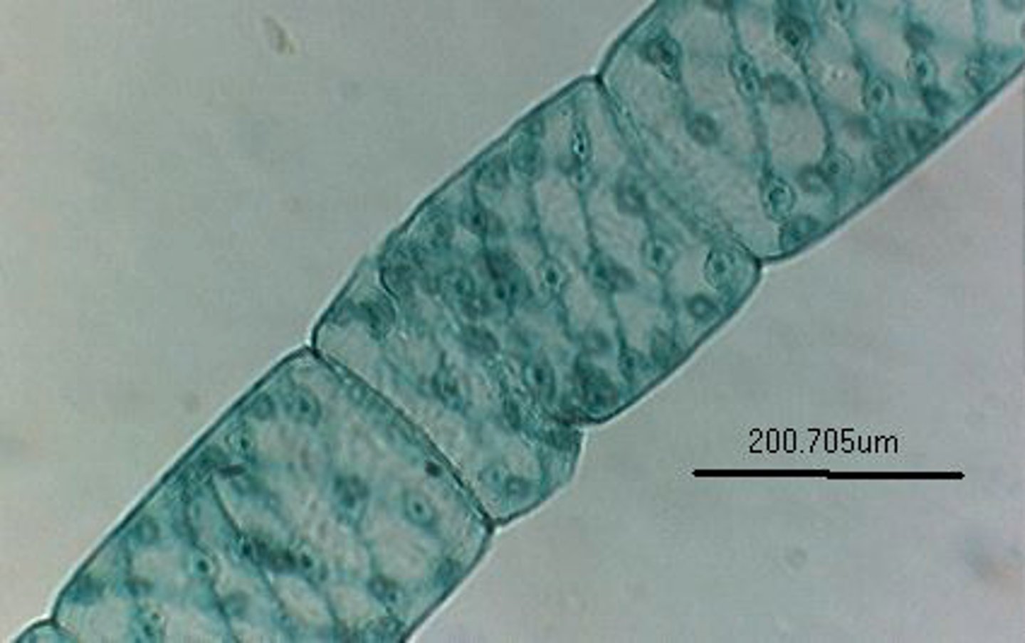 <p>Identify the Green alga shown</p>