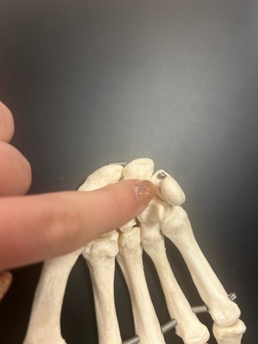 <p>name the bone</p>