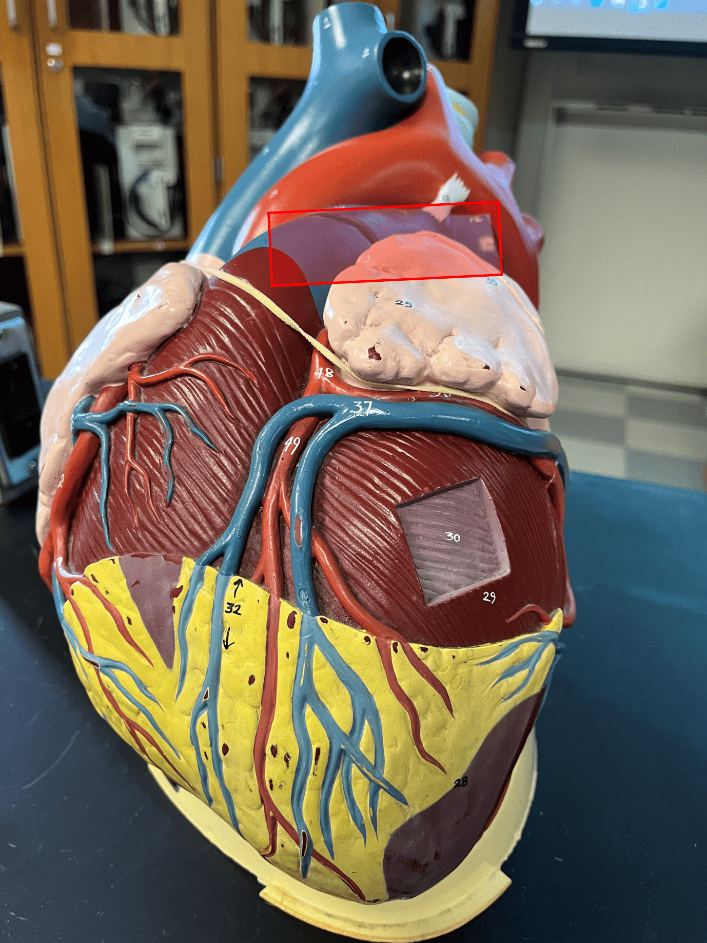• A great vessel of the heart.

• Carries deoxygenated blood from the right ventricle and branches off into the pulmonary circuit.