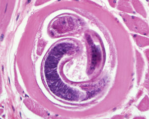 <p>Trichinella spiralis (parasite)</p>