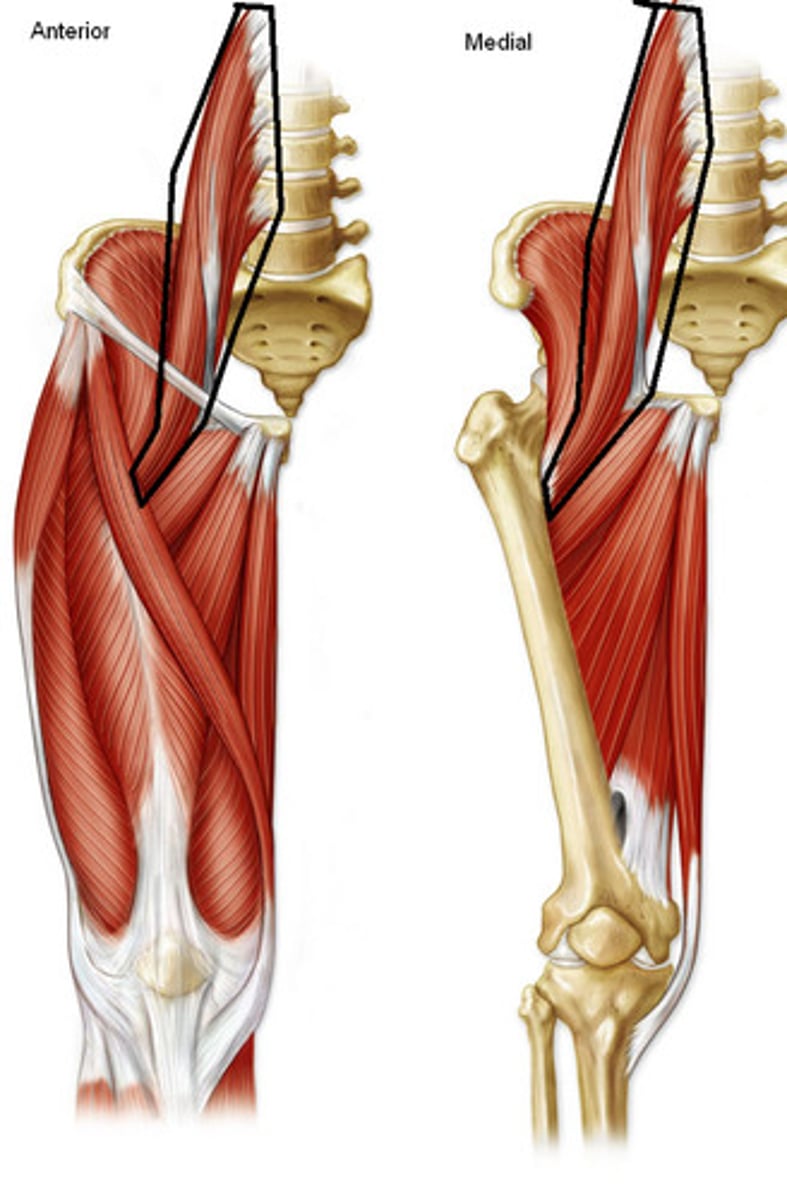 <p>Origin: vertebrae T12-L4</p><p>Insertion: Lesser trochanter</p><p>Action: Flexes and rotates hip</p>