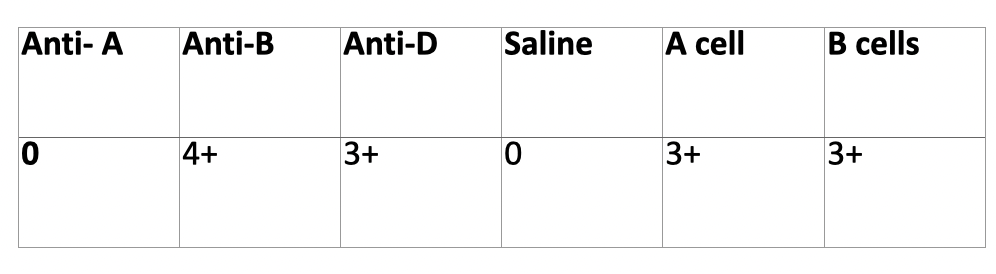 <p>Patient has anti-M, discrepancy?</p><p>What would fix it?</p>