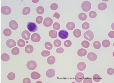 <p>what disease/condition is associated with macrocytes?</p>