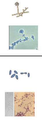 <p>Mould - septate hyphae with conidiophores bearing conidia</p><p>Yeast - cigar shaped pleomorphic budding yeast cells </p>
