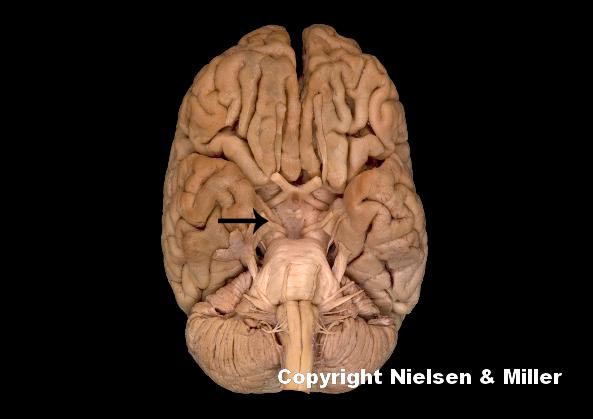 <p>what is indicated nerve</p>