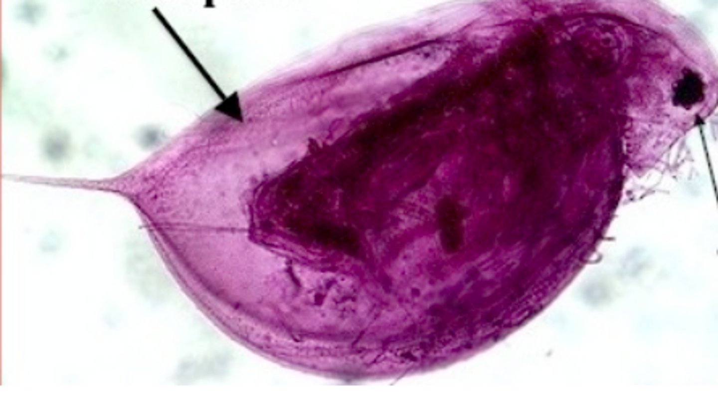 <p>Phylum Arthropoda<br>Sub-Phylum Crustacea<br>carapace</p>
