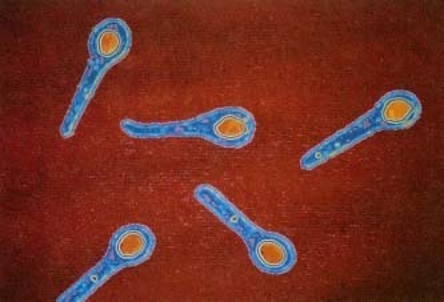<p>Endospores that are found at the end of a bacterial cell</p>