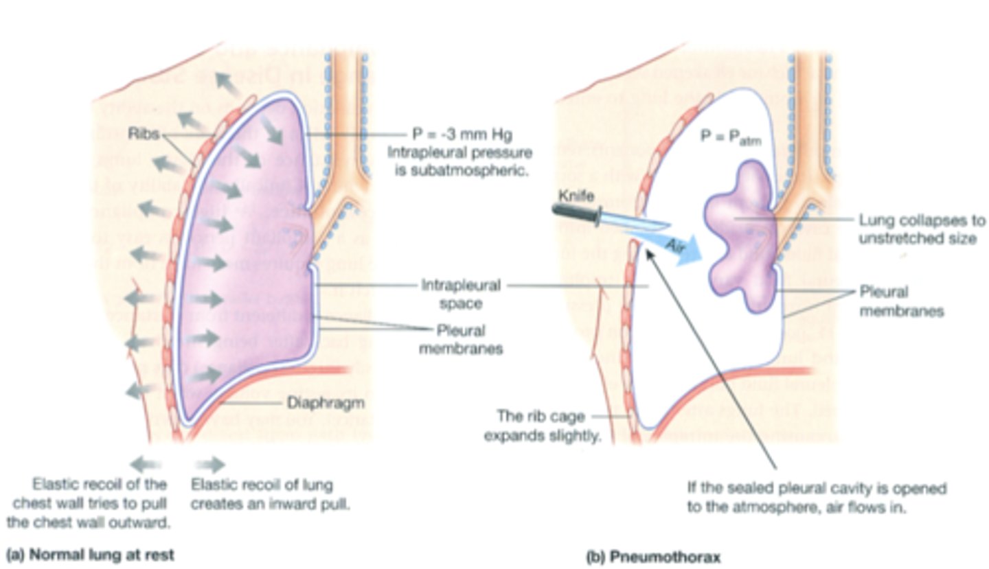 <p>air flows into the pleural cavity --&gt; chest is separated from the lung --&gt; elastic recoil of chest wall that pulls the lung outward is no longer present --&gt; lung collapsed to unstretched size</p>