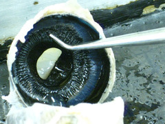 <p>ciliary body</p>