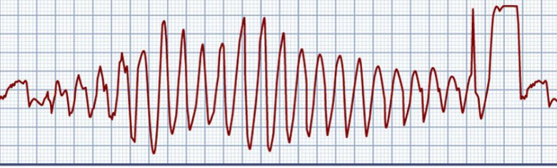 <p>What Rhythm is this?</p>