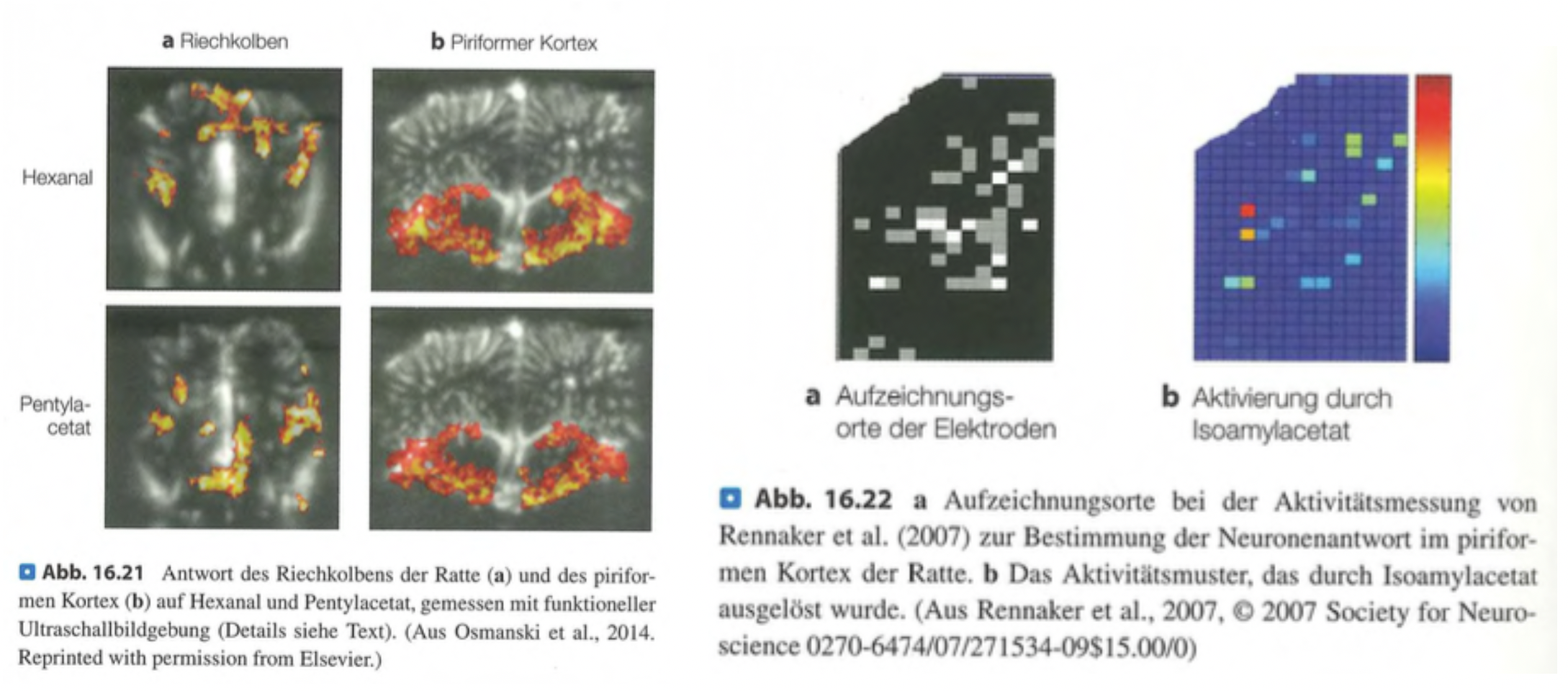<p><span data-name="check_mark_button" data-type="emoji">✅</span> <strong>Kurzversion:</strong><br>Im Gegensatz zum geordneten Riechkolben zeigt der <strong>piriforme Kortex</strong> keine klaren Karten mehr. Stattdessen erzeugen Gerüche dort <strong>verteilte, überlappende Aktivierungsmuster</strong>, was die komplexe Wahrnehmung von Geruchsobjekten wie Kaffee ermöglicht.</p><div data-type="horizontalRule"><hr></div><p class=""><span data-name="brain" data-type="emoji">🧠</span> <strong>Langversion:</strong></p><ul><li><p class=""><strong>Riechkolben:</strong> Enthält klare „odotopische“ Karten – jeder Geruchsstoff aktiviert spezifische Glomeruli.</p></li><li><p class=""><strong>Piriformer Kortex:</strong> Diese Ordnung <strong>geht verloren</strong>. Gerüche aktivieren <strong>weit verteilte Neuronengruppen</strong> ohne feste räumliche Zuordnung.</p></li><li><p class=""><strong>Grund:</strong> Die Projektionen vom Riechkolben in den Kortex sind <strong>diffus und breit gestreut</strong>.</p></li><li><p class=""><strong>Beleg:</strong> Bildgebende Studien (z. B. mit Hexanal oder Isoamylacetat) zeigen <strong>kein lokales Aktivierungsmuster</strong>.</p></li><li><p class=""><strong>Bedeutung:</strong> Diese diffuse Codierung erlaubt es, <strong>komplexe Geruchsobjekte</strong> (z. B. Kaffee) zu erkennen, die aus vielen Komponenten bestehen.</p></li></ul><p></p>