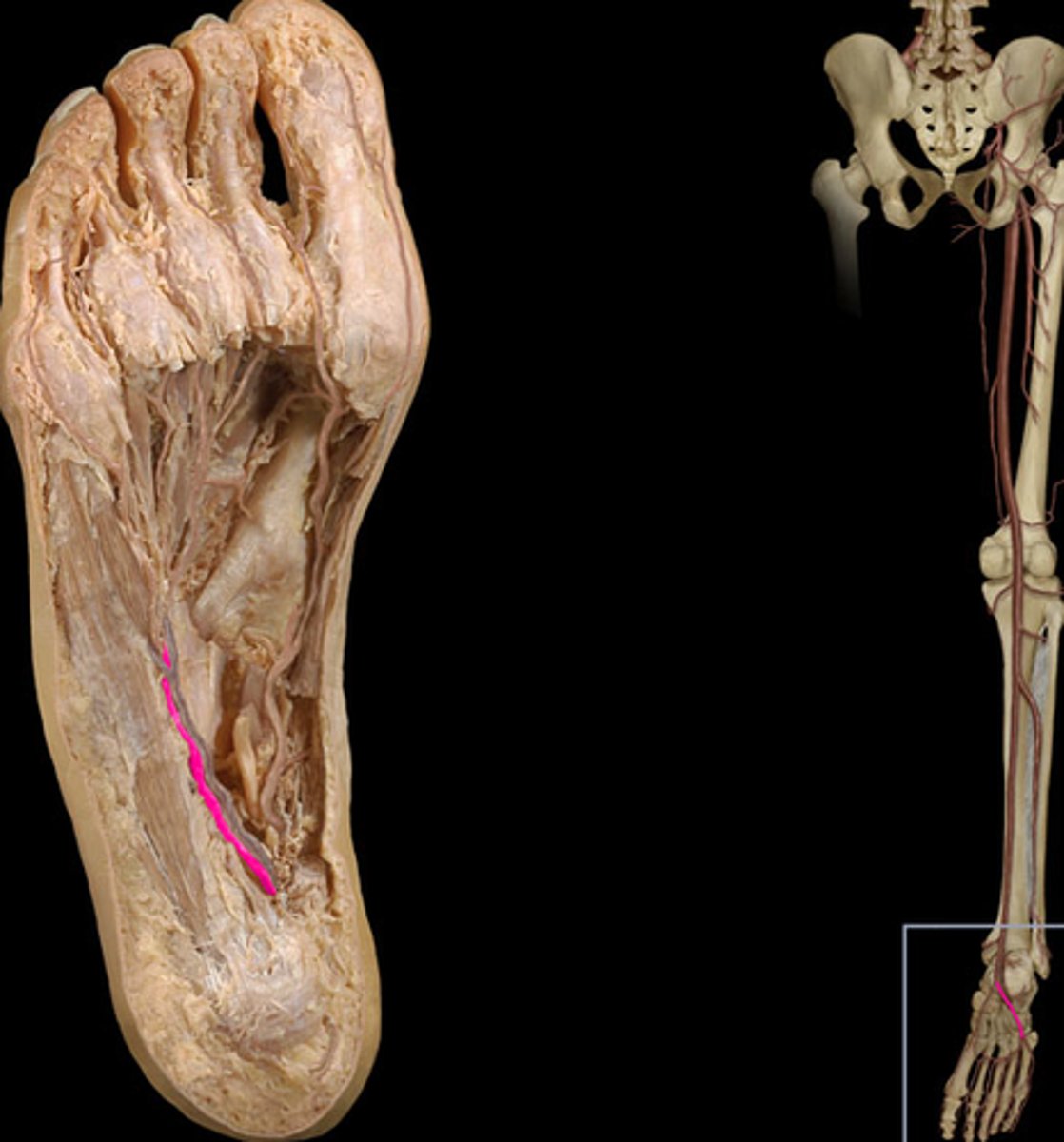 <p>Forms the deep plantar arterial arch on the sole of the food</p>