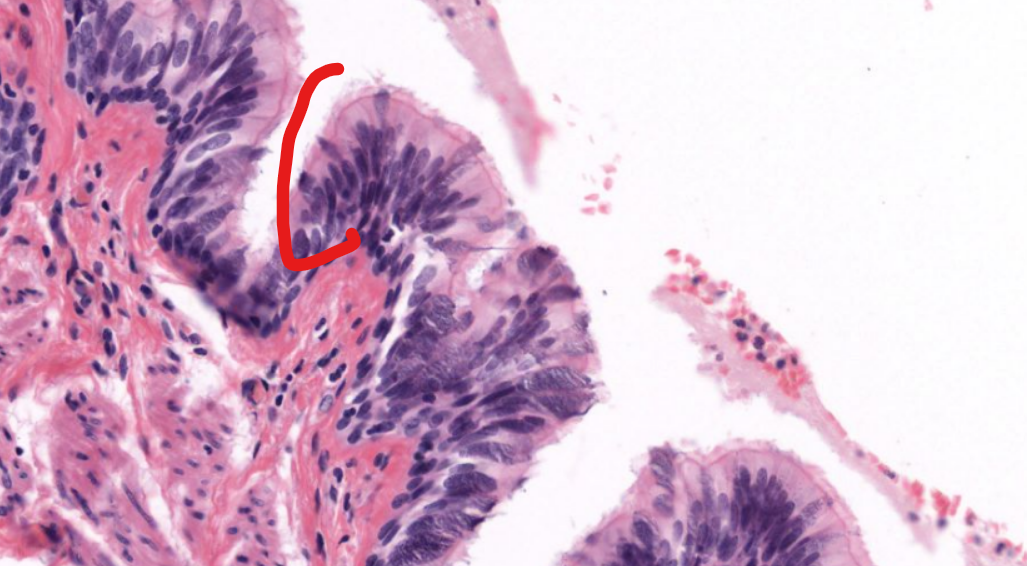 <p>tissue type</p>