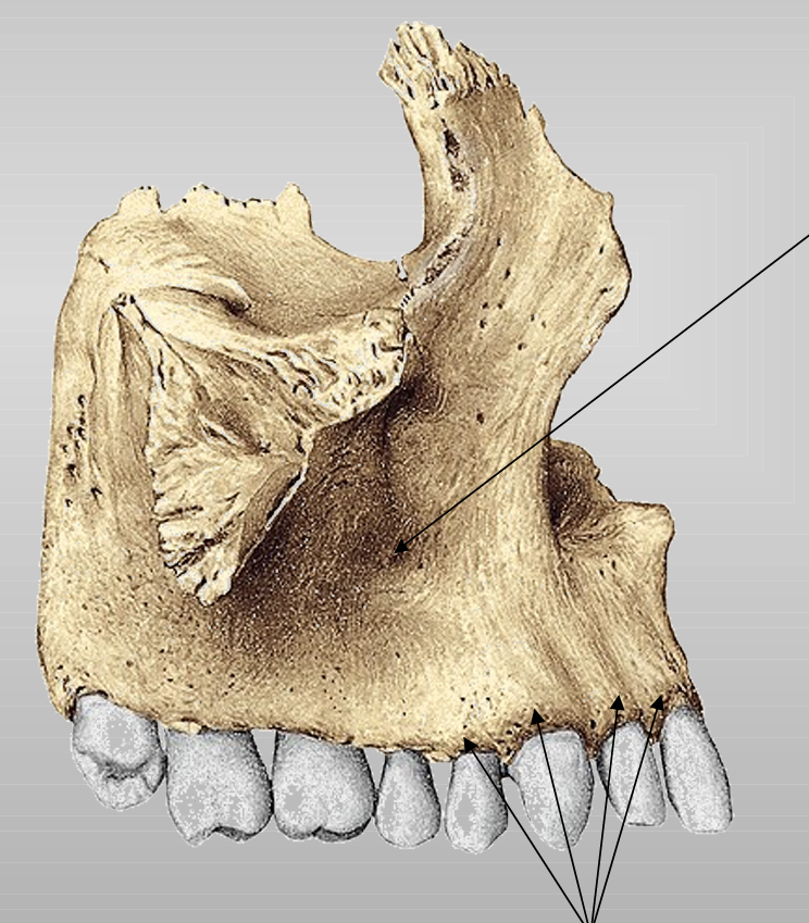 <p>inzinking op corpus maxillae</p>