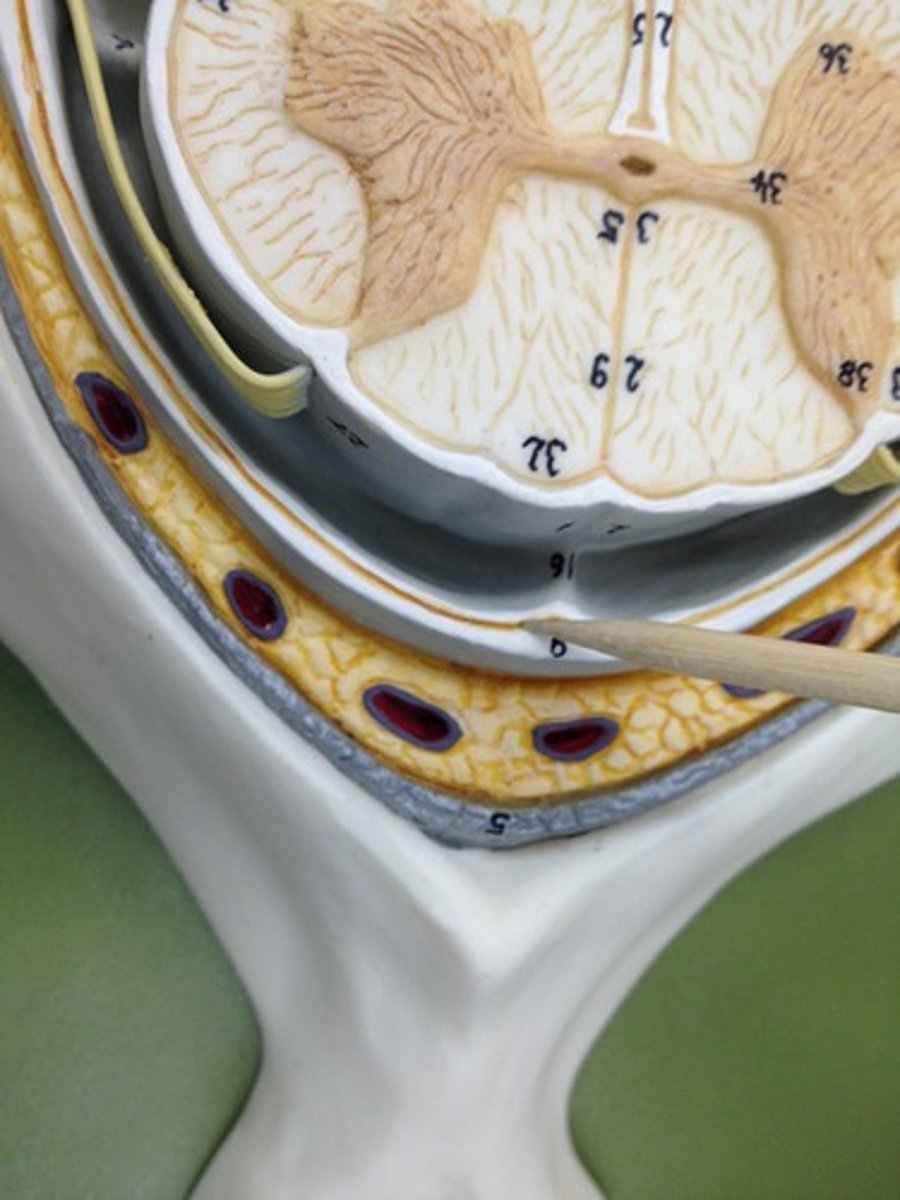 <p>space between dura mater and arachnoid mater</p>