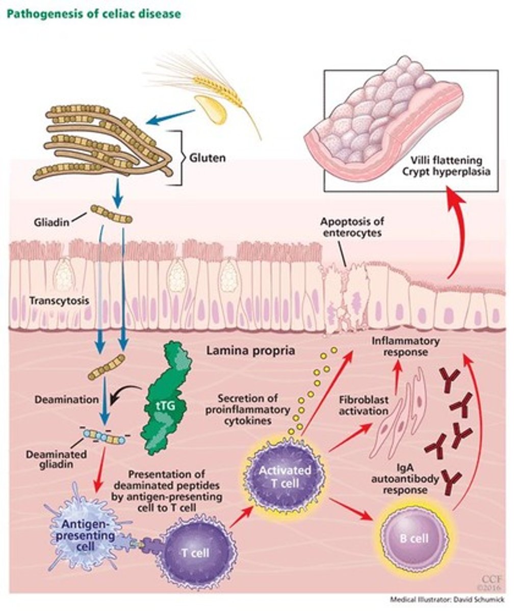 <p>The ingestion of gluten, a protein found in wheat and some grains.</p>