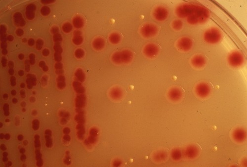 How many species of bacteria are on this streak plate?