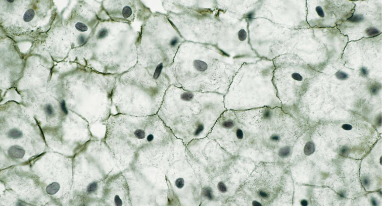 <p>What tissue is this </p>