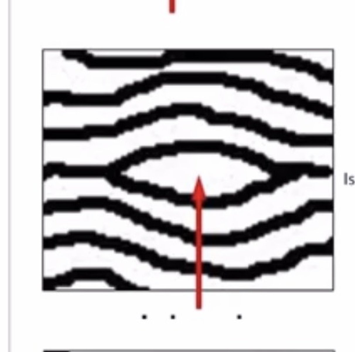 <p>A ridge that bifurcates and reunites a short time after to form a single ridge</p>