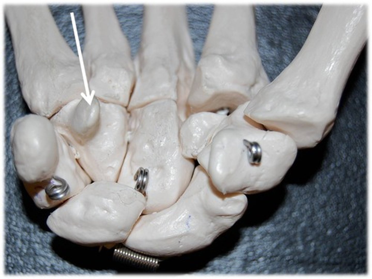 <p>Name the carpal bone</p>