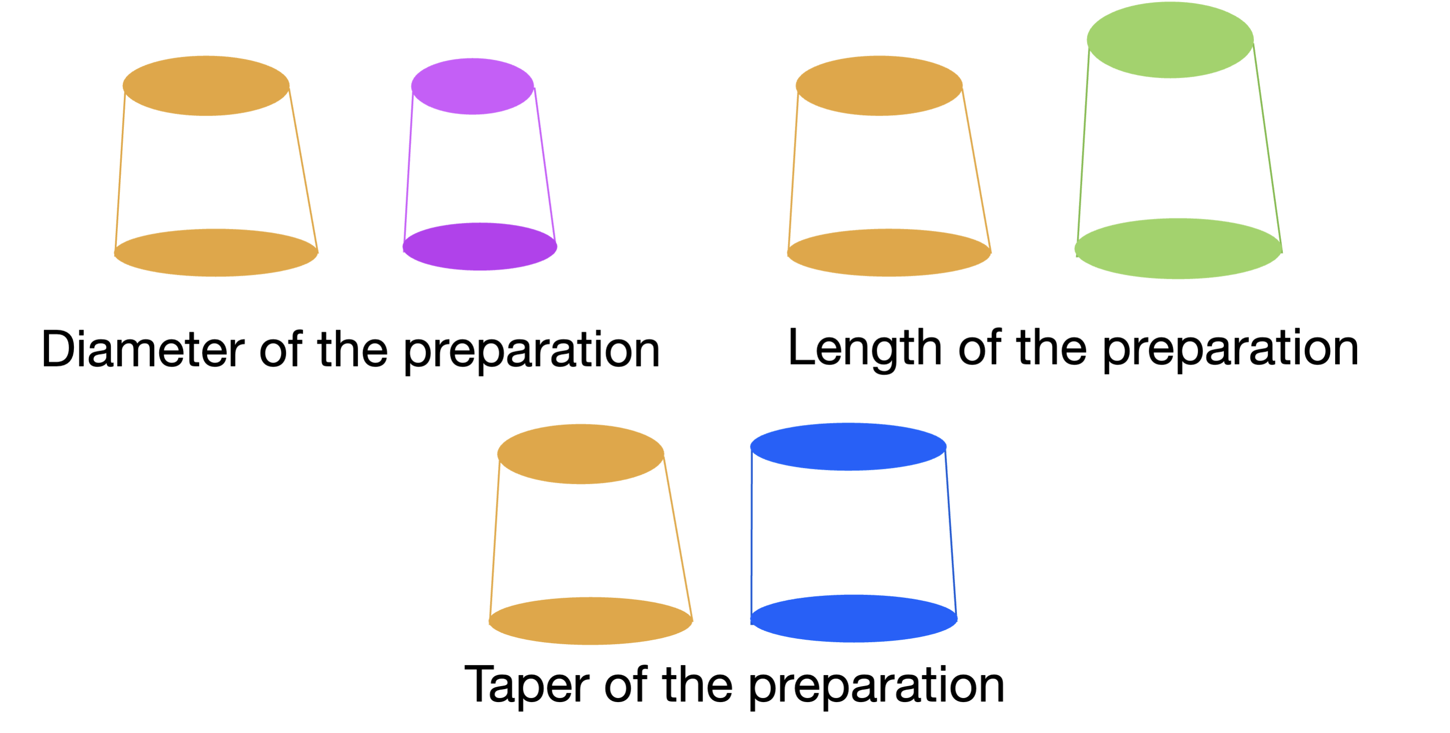 <ul><li><p>diameter of the preparation&nbsp;</p></li><li><p>length of the preparation&nbsp;</p></li><li><p>taper of the preparation&nbsp;</p></li></ul><p></p>