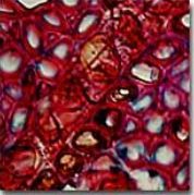 <p>what kind of Resolution error in photomicrography is this ? </p>