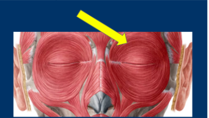 What is the name and function of this muscle?