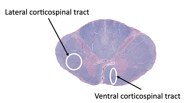 <p><strong>direct motor pathways</strong></p><ul><li><p>lateral corticospinal tract:</p><ul><li><p>motor cortex control skeletal muscles on the _____ side of the body</p></li><li><p>precise, voluntary movements of the arms and legs</p></li><li><p>fibers cross at the ________</p></li></ul></li></ul><p></p>