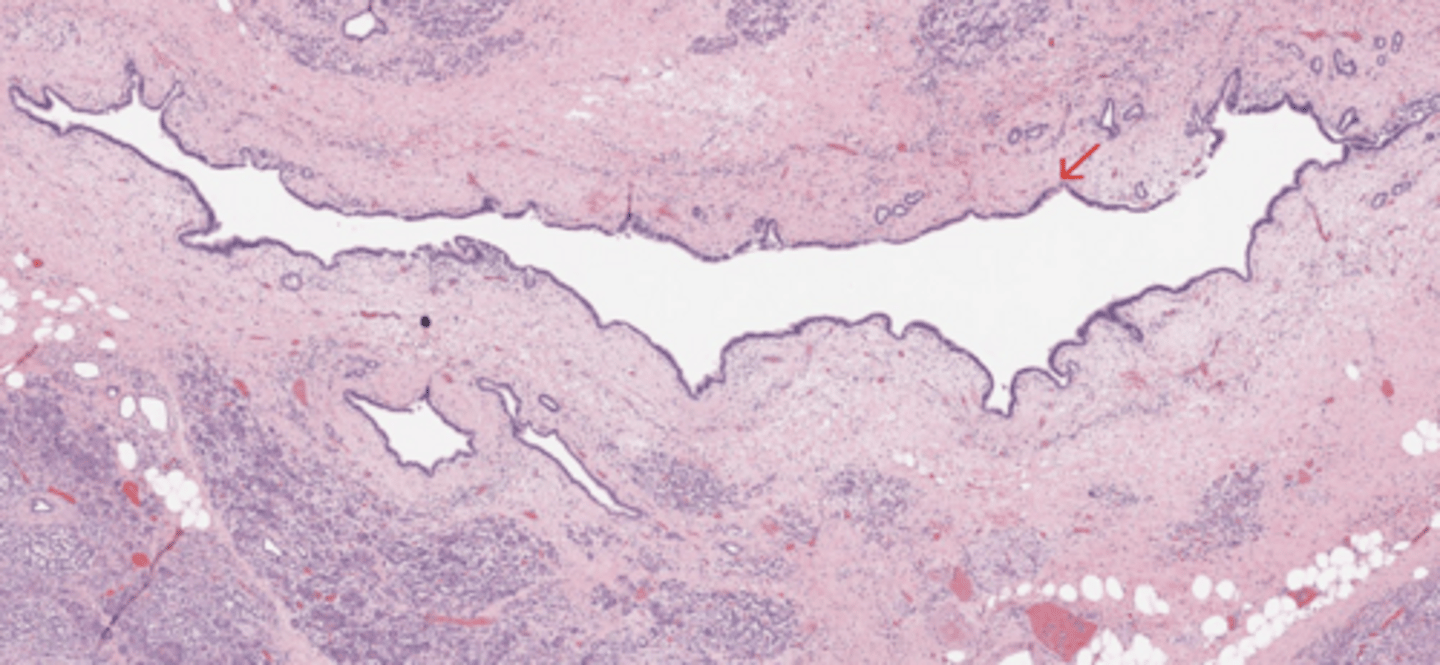 <p>Pancreas</p>